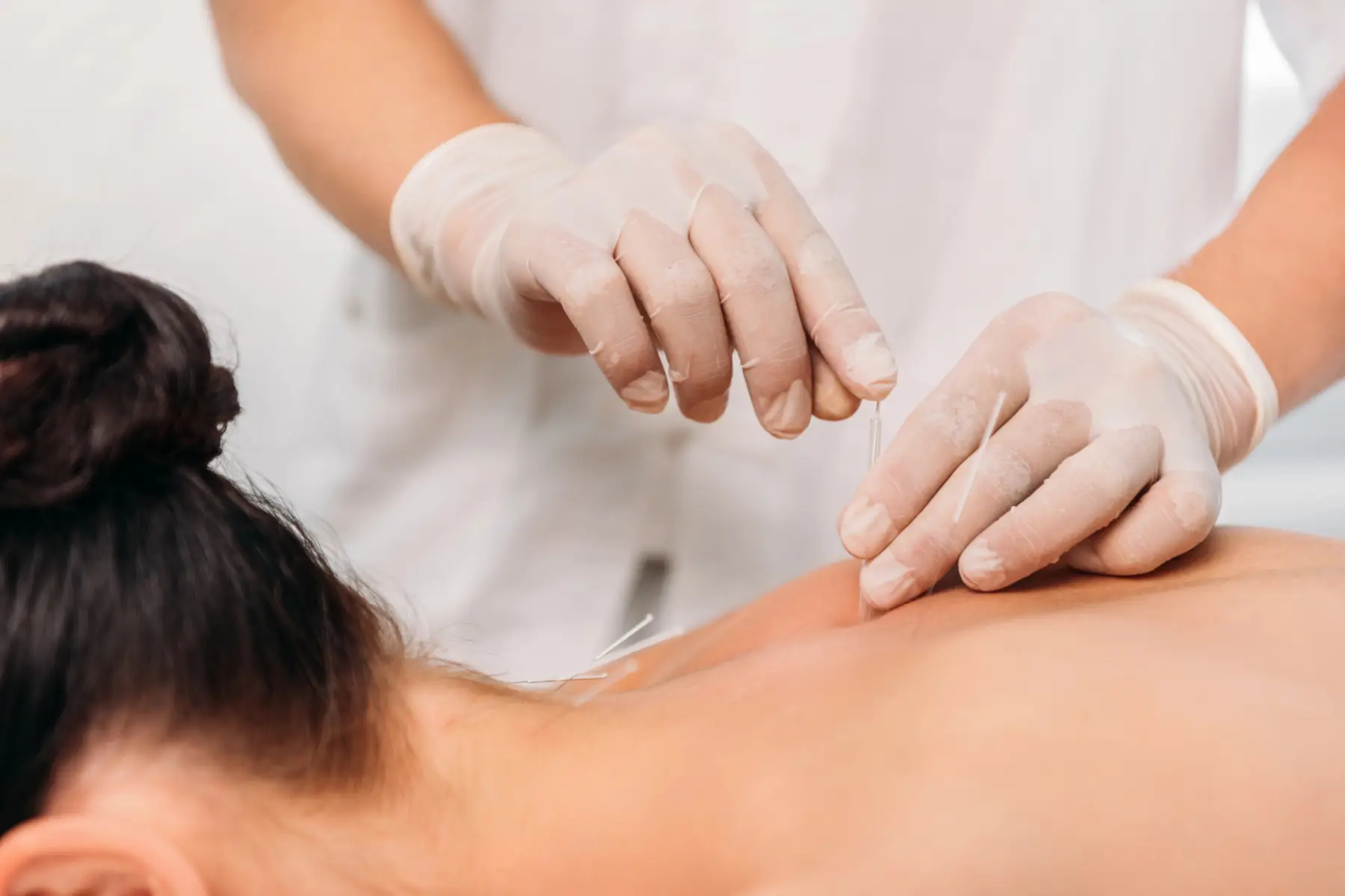 acupuncture-treatments-aldeburgh